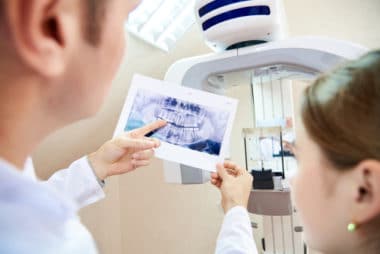 Dental X-Rays in Buffalo, NY Cone Beam CT Todd Shatkin DDS