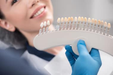 Porcelain Veneers in Buffalo, NY | Todd Shatkin DDS | Buffalo Dentist