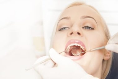 5 Reasons Dental Check Ups Are Important | Todd Shatkin DDS | Buffalo