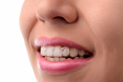 Fixing Gapped Teeth | Todd Shatkin DDS | Buffalo Dentist