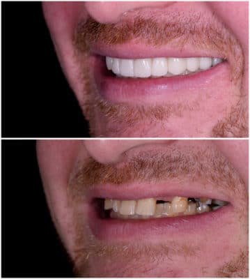 Improve Your Smile with Cosmetic Dentistry