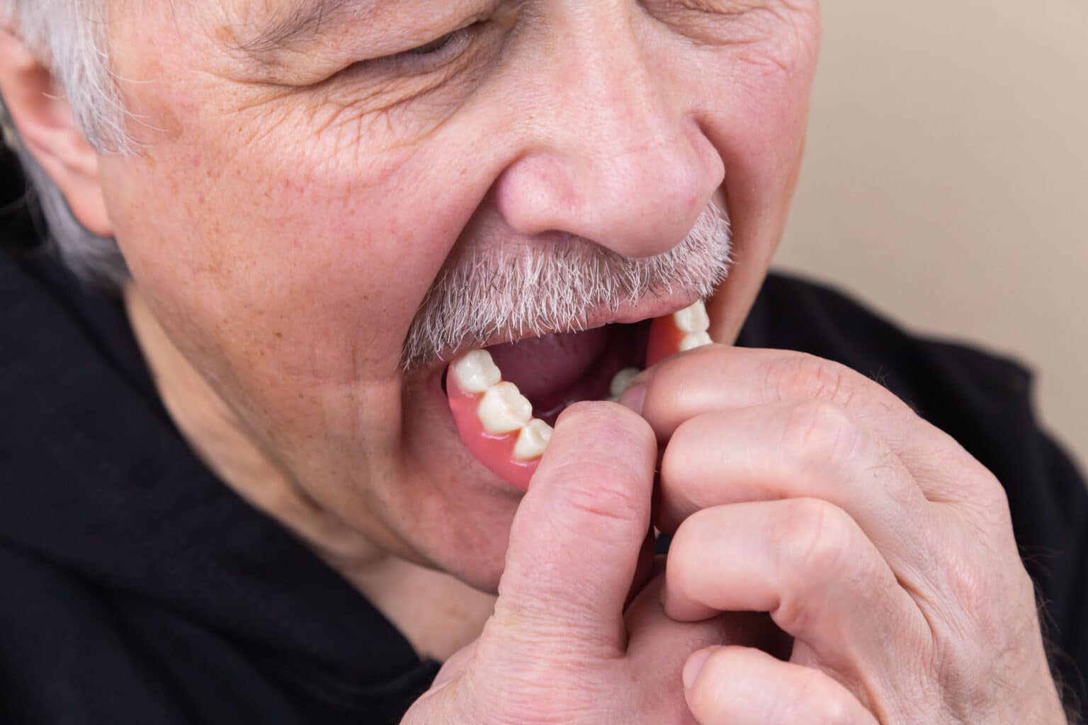 Solutions to LooseFitting Dentures Buffalo Dentist Free Consultations