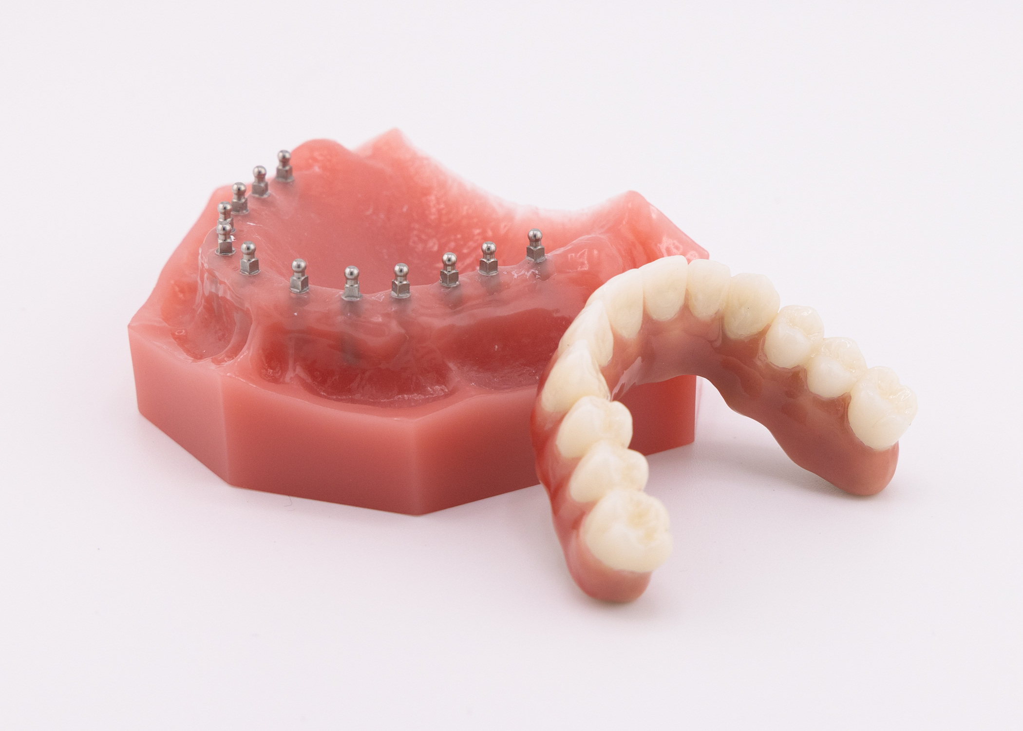 Full Arch Dental Implants in Buffalo, NY | Free Consultations