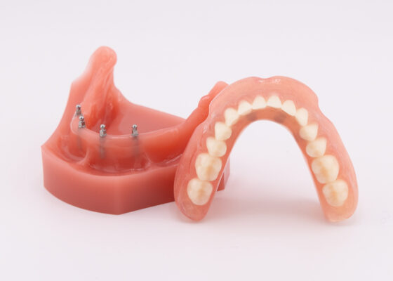 Mini Dentures in Buffalo, NY | Affordable Dental Implant Treatment