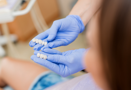 Price of Veneers in Buffalo, NY | Free Consultations & Financing!